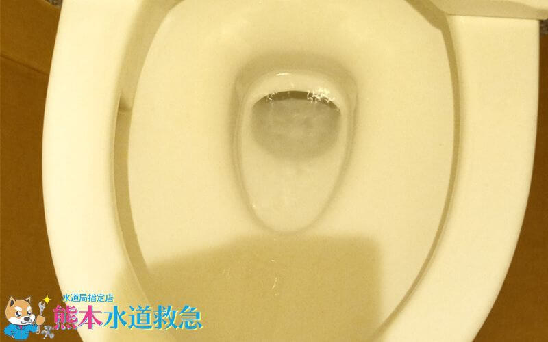 トイレつまり修理｜高圧ポンプで押し流し解決！【熊本県阿蘇市の事例】